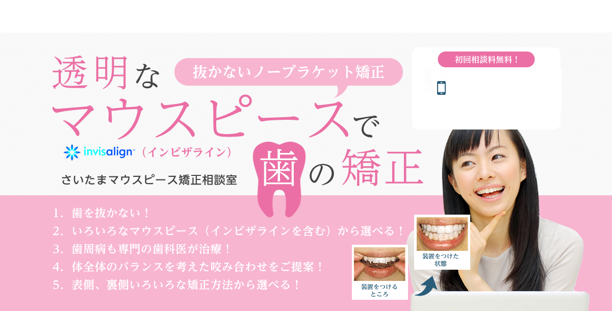 透明なマウスピース（抜かないノーブラケット矯正）で歯の矯正